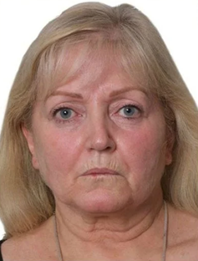 Anonymous Before