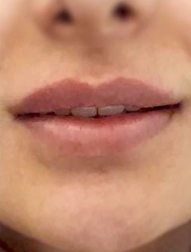 Anonymous Before