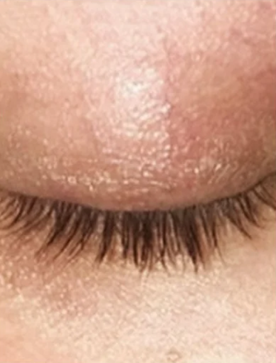 Anonymous Before