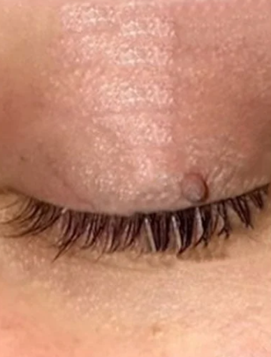 Anonymous Before
