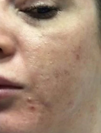 Anonymous Before