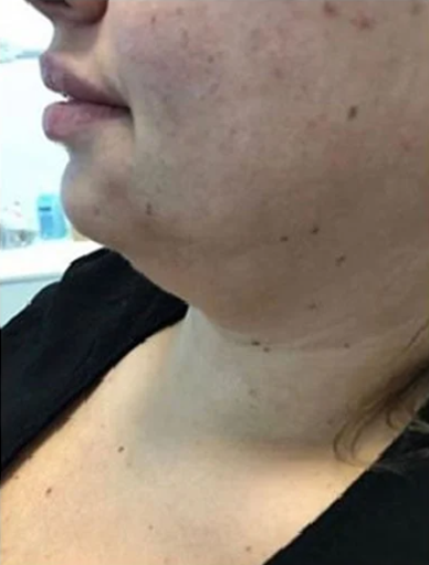 Anonymous Before