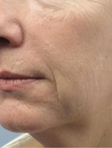 Anonymous Before