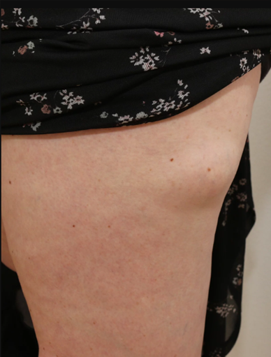 Anonymous Before
