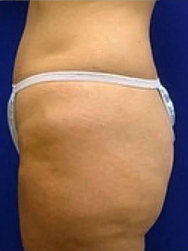 Giorgia Smith Before