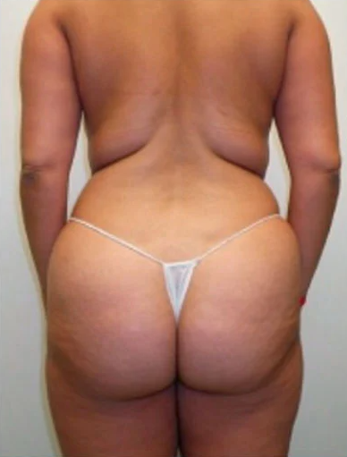 Elena Scott Before