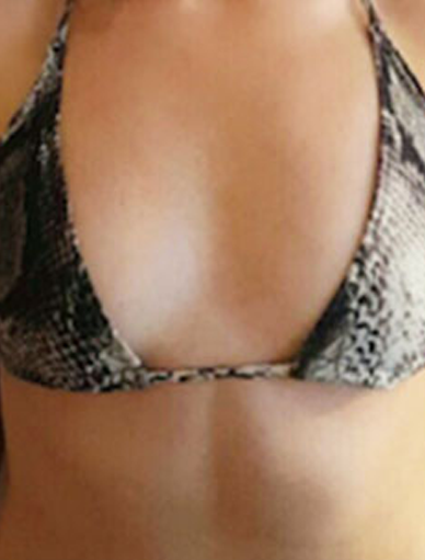 Anonymous Before