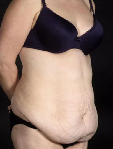 Anonymous Before