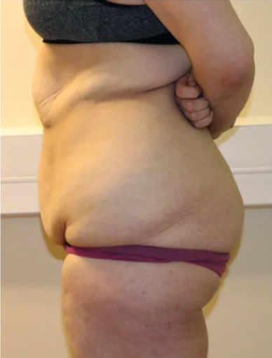 Anonymous Before