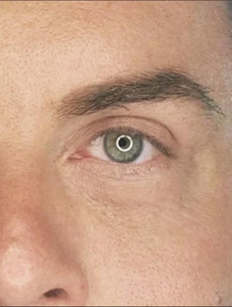 Anonymous Before