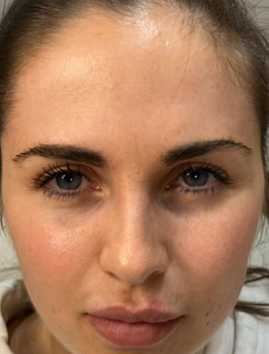 Anonymous Before