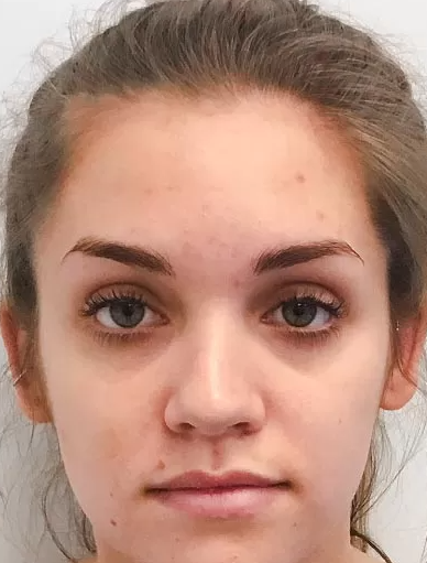 Anonymous Before