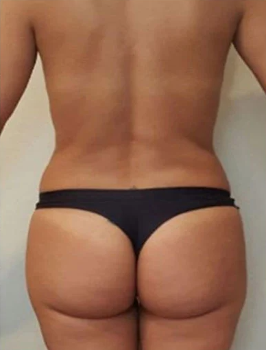 Giorgia Smith Before