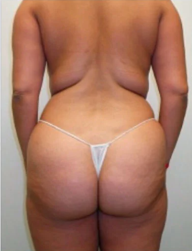 Sarah McDermott Before