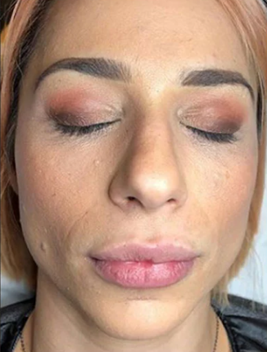 Anonymous Before