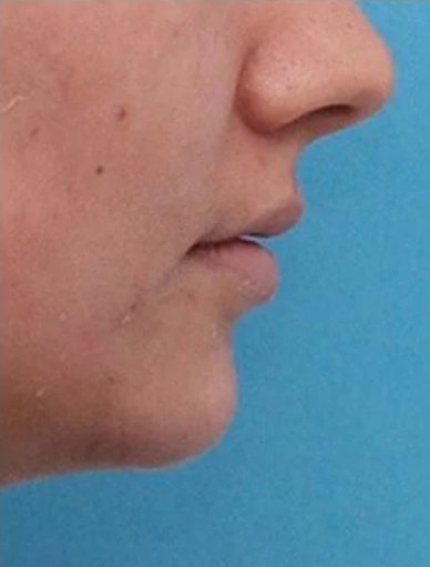 Anonymous Before