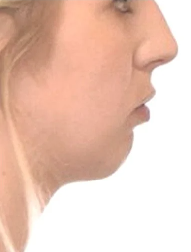 Anonymous Before