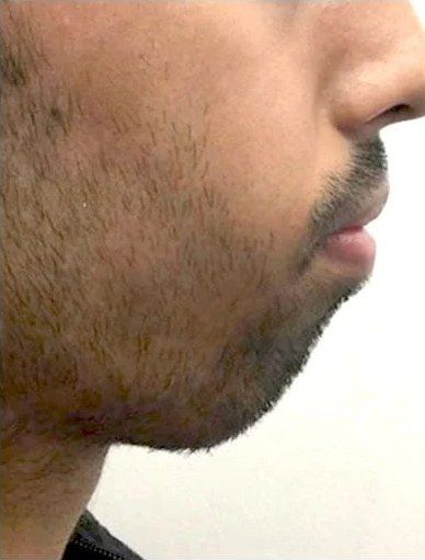 Anonymous Before