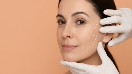 Facelift: Understanding the Procedure, Benefits, and Risks