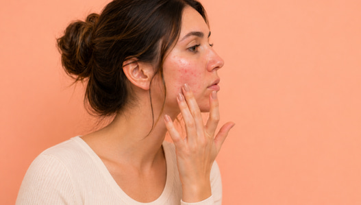 Understanding Bumps After Microneedling – What’s Normal & When to Act