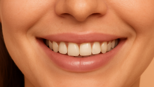 Azzalure vs Botox: Which is Right for You?