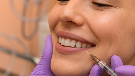 What is Russian Lip Filler?