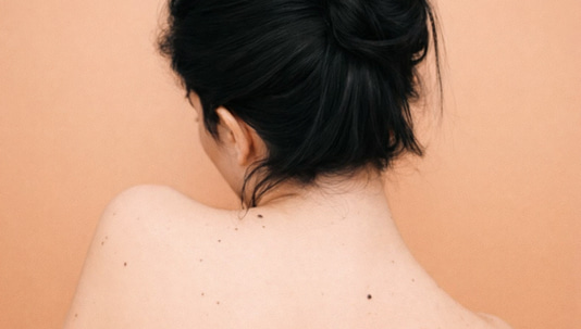 The 5 Main Types of Moles You Need to Know About The 5 Main Types of Moles You Need to Know About