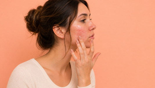 Understanding Bumps After Microneedling – What’s Normal & When to Act