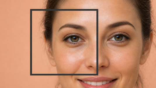 Blepharoplasty Before and After: Real Results Guide