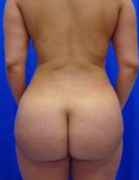 Sarah McDermott After