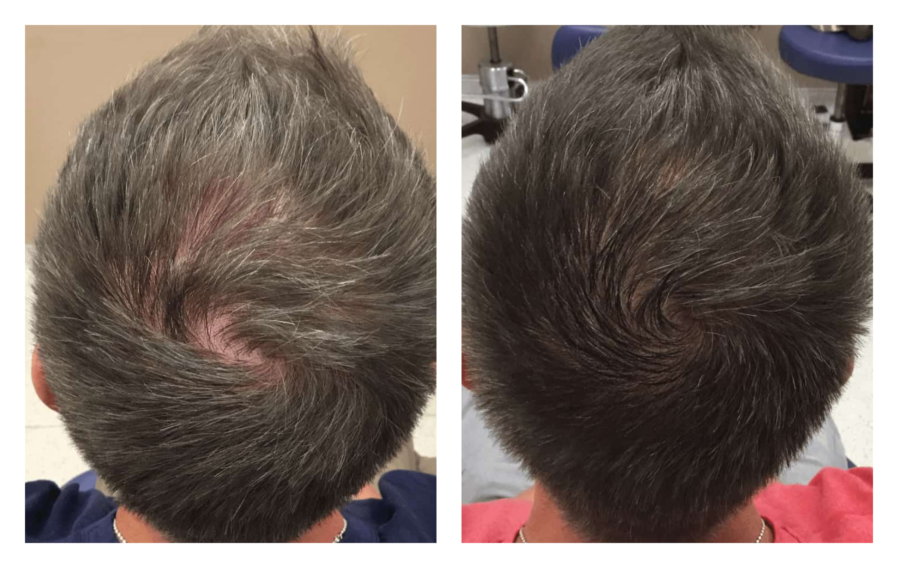 Issue #2 | The Hair raiser